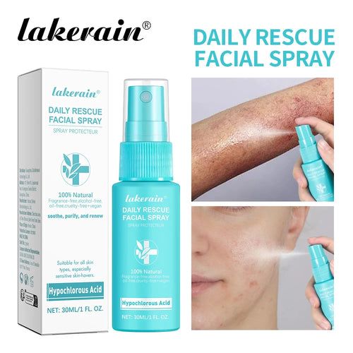 Hypochlorous Acid Facial Mist
